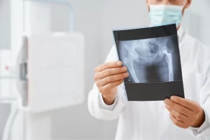 Avances en tecnología para traumatología: Innovación al servicio de la recuperación